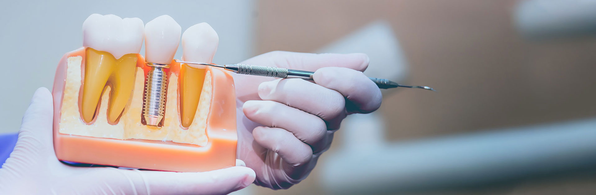 dental implants in falmouth